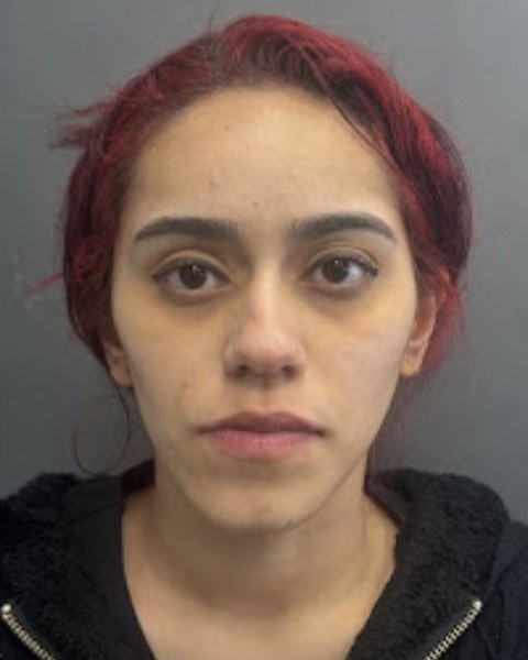 Patient 2 before orthognathic surgery, frontal view